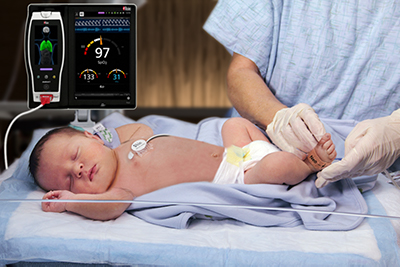Masimo Root with Radical-7, RRa, and the RAS-45 Infant/Neonatal Sensor