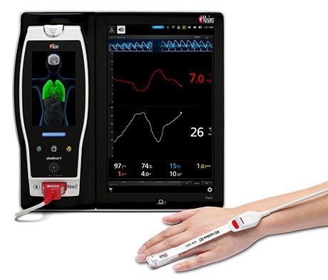 patient hand equiped with ORi next to Masimo Root Device
