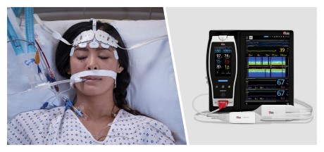 Masimo Root® with O3® Regional Oximetry and SedLine® Brain Function Monitoring