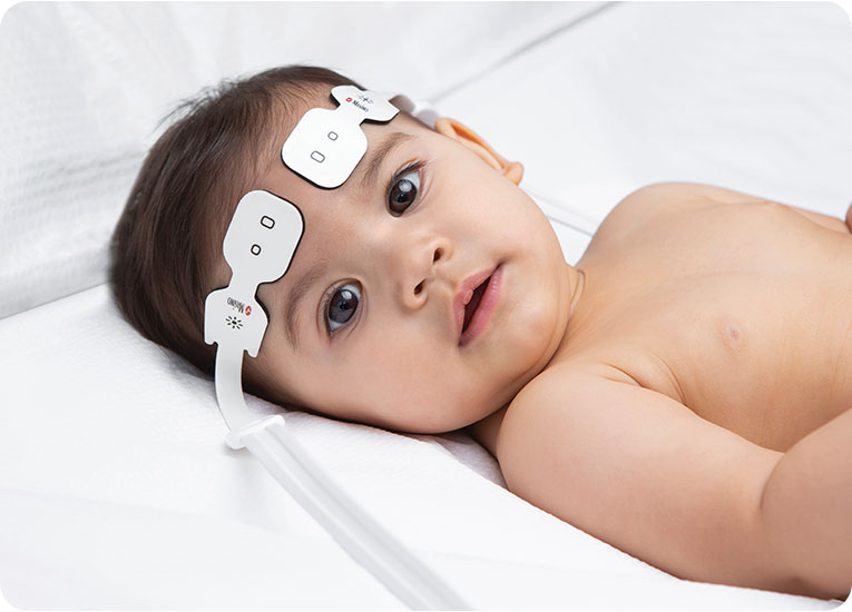 Masimo - infant in medical bed with sensor on forehead
