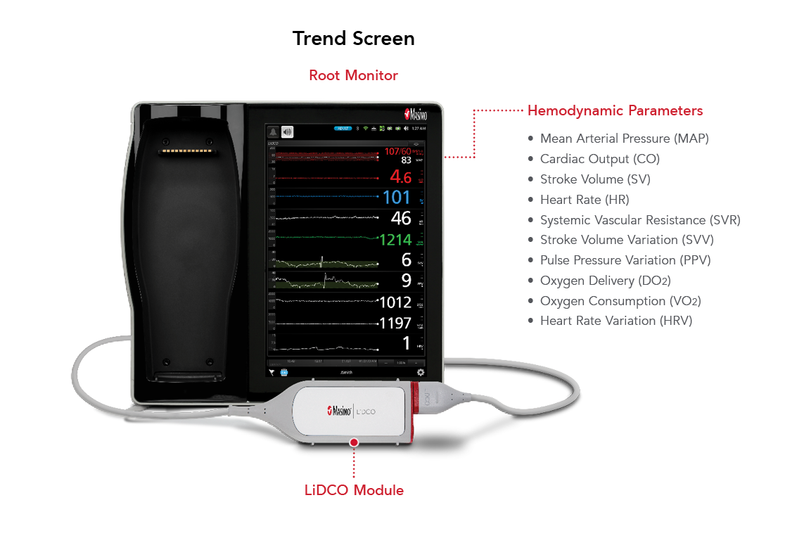 Key Features of LiDCO on Root Display Monitor