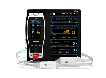 Masimo Root patient monitoring hub.